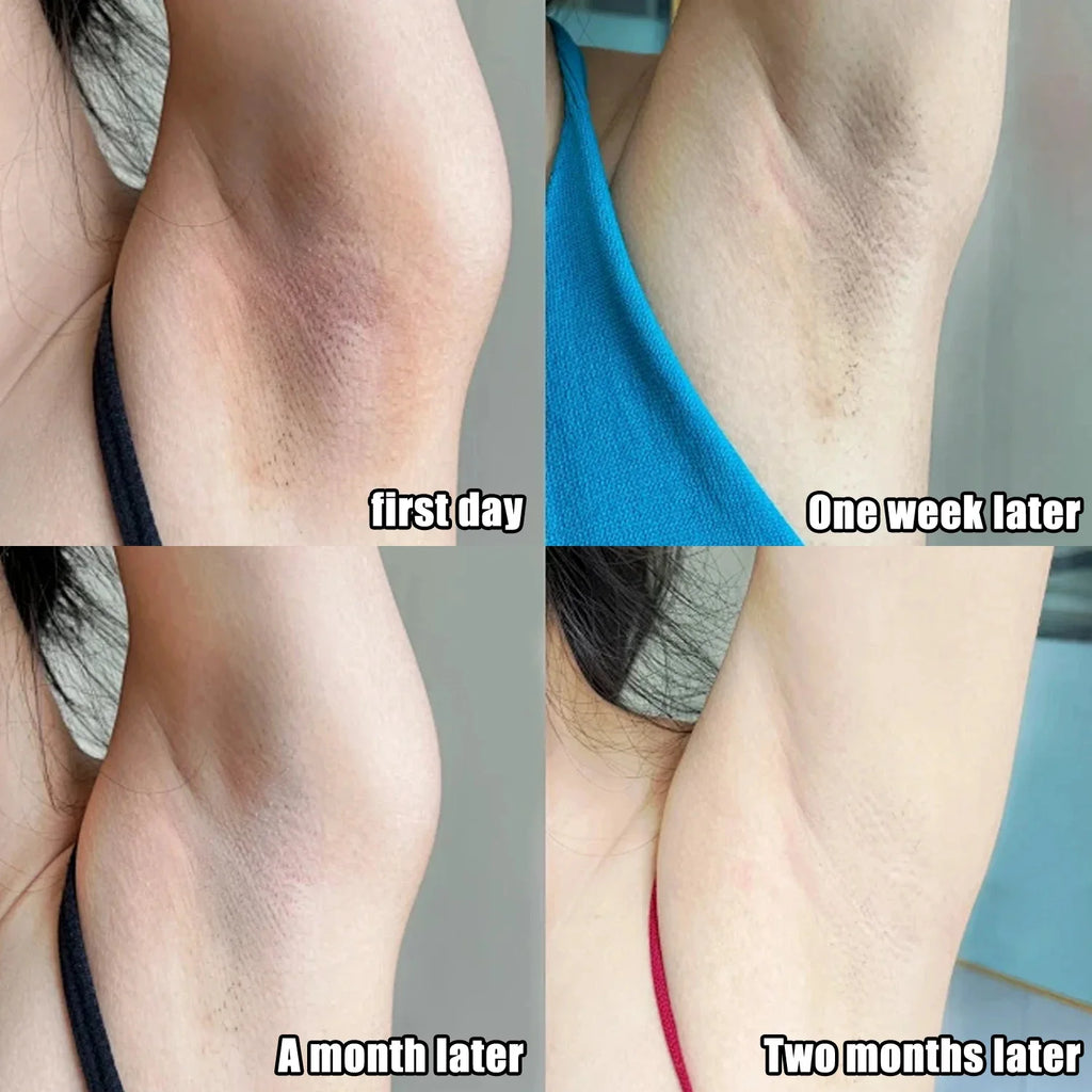 Intimate Area Brightening Serum for Underarms, Buttocks, Knees, and Inner Thighs