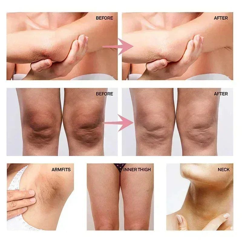 Intimate Area Brightening Serum for Underarms, Buttocks, Knees, and Inner Thighs