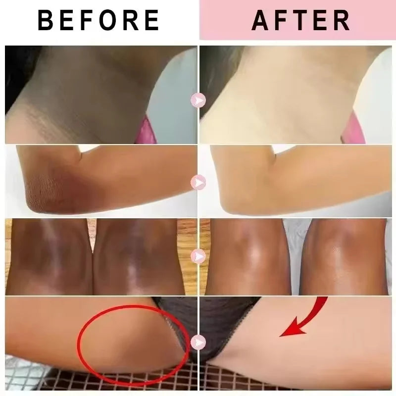Nicotinamide Brightening Cream for Even Skin Tone and Radiance in Sensitive Areas