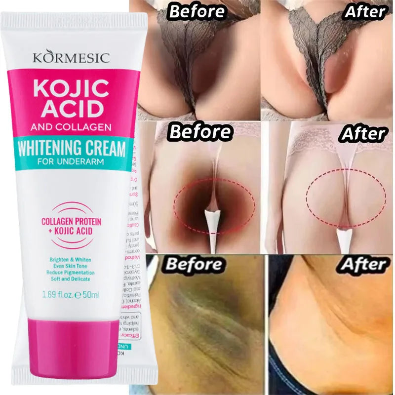 Intimate Area Brightening Serum for Underarms, Buttocks, Knees, and Inner Thighs